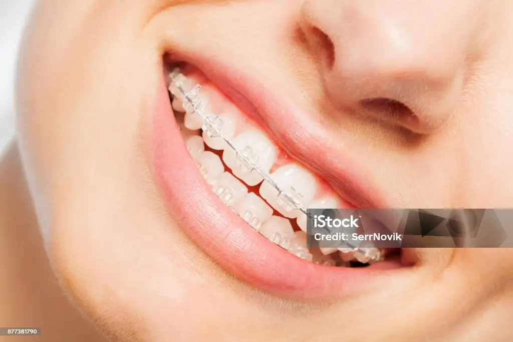 Orthodontic Treatment (Braces / Clear Aligners)